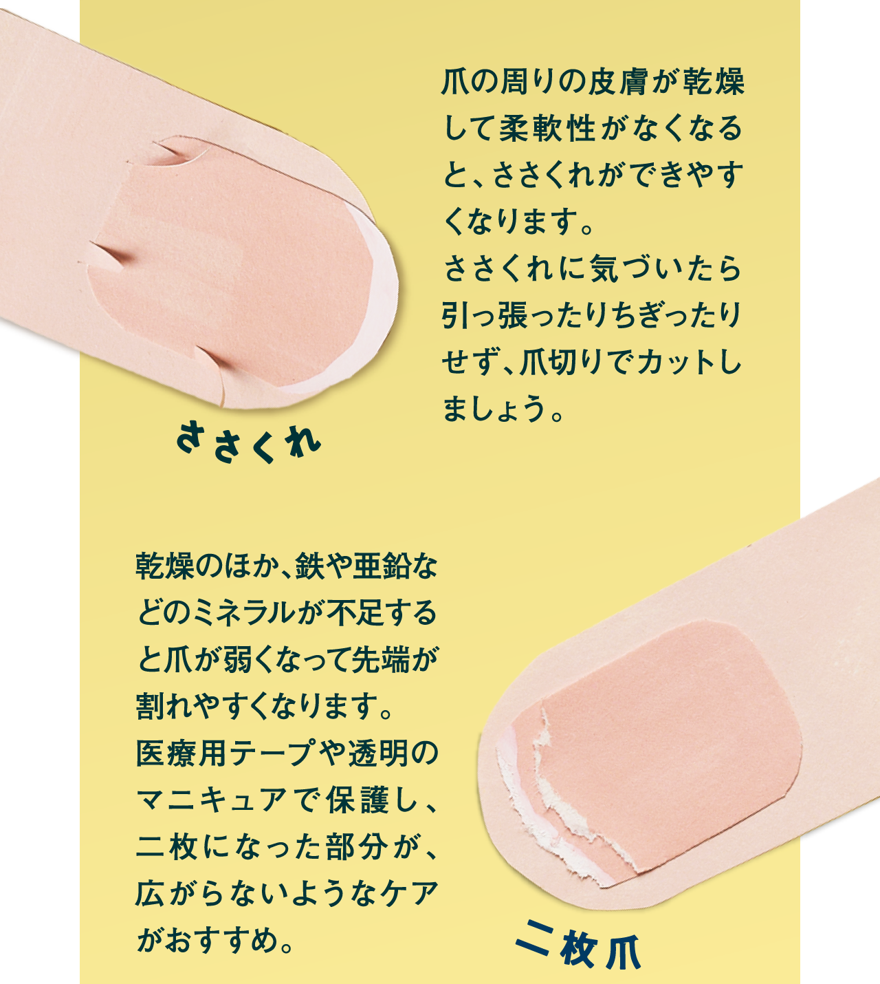 ささくれ　二枚爪