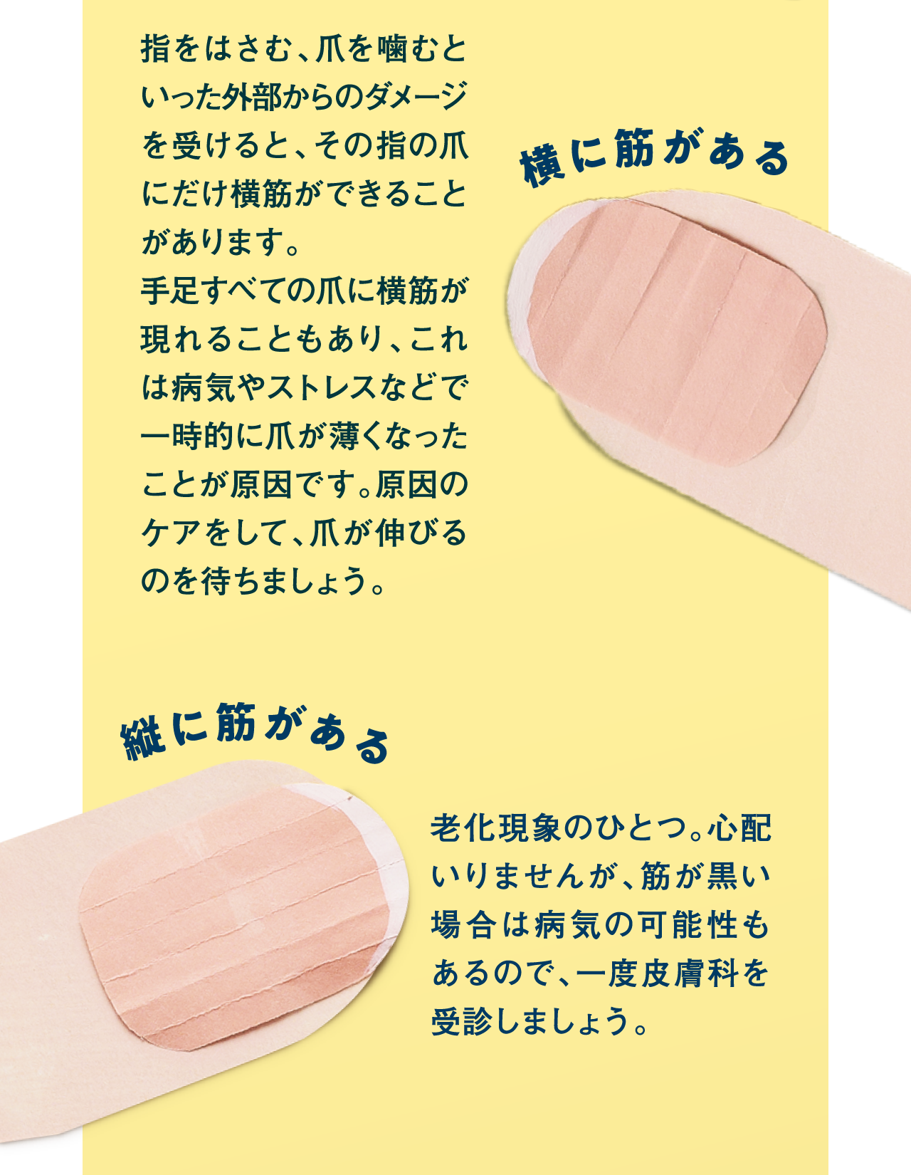 横に筋がある　縦に筋がある