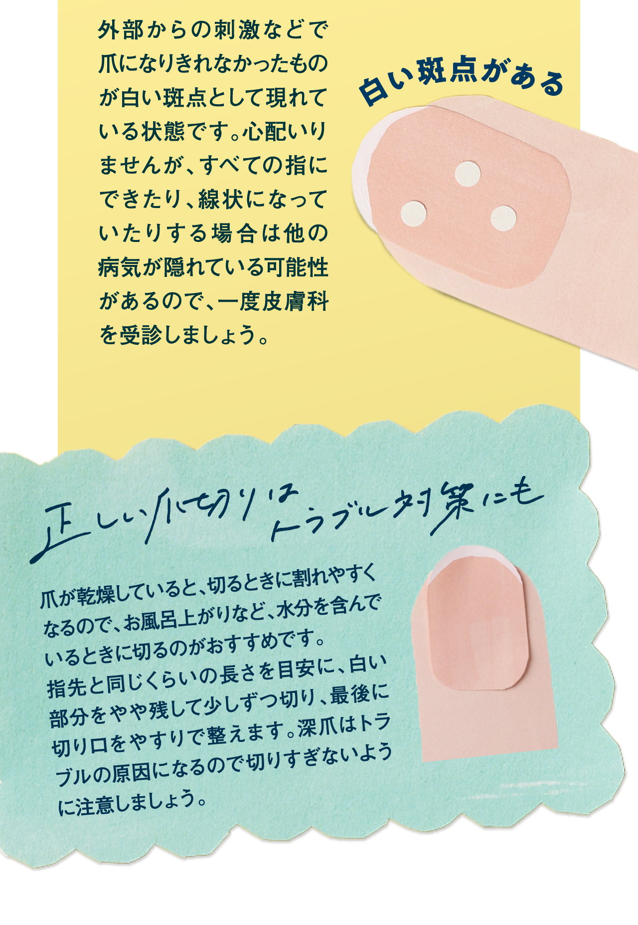 白い斑点がある　正しい爪切りはトラブル対策にも