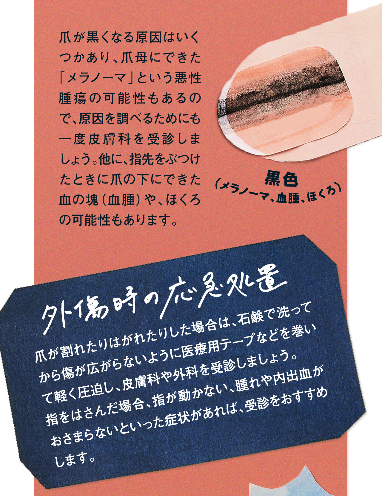 メラノーマ、血腫、ほくろ